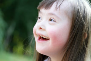 young girl with down's syndrome looks up while smiling